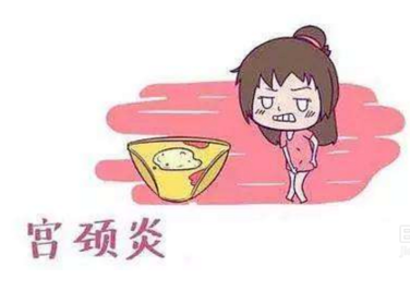 妇科白带91视频网站入口厂家分析宫颈炎的症状